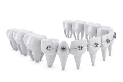 dental braces | cornwall dentists