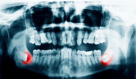 oral surgery cornwall